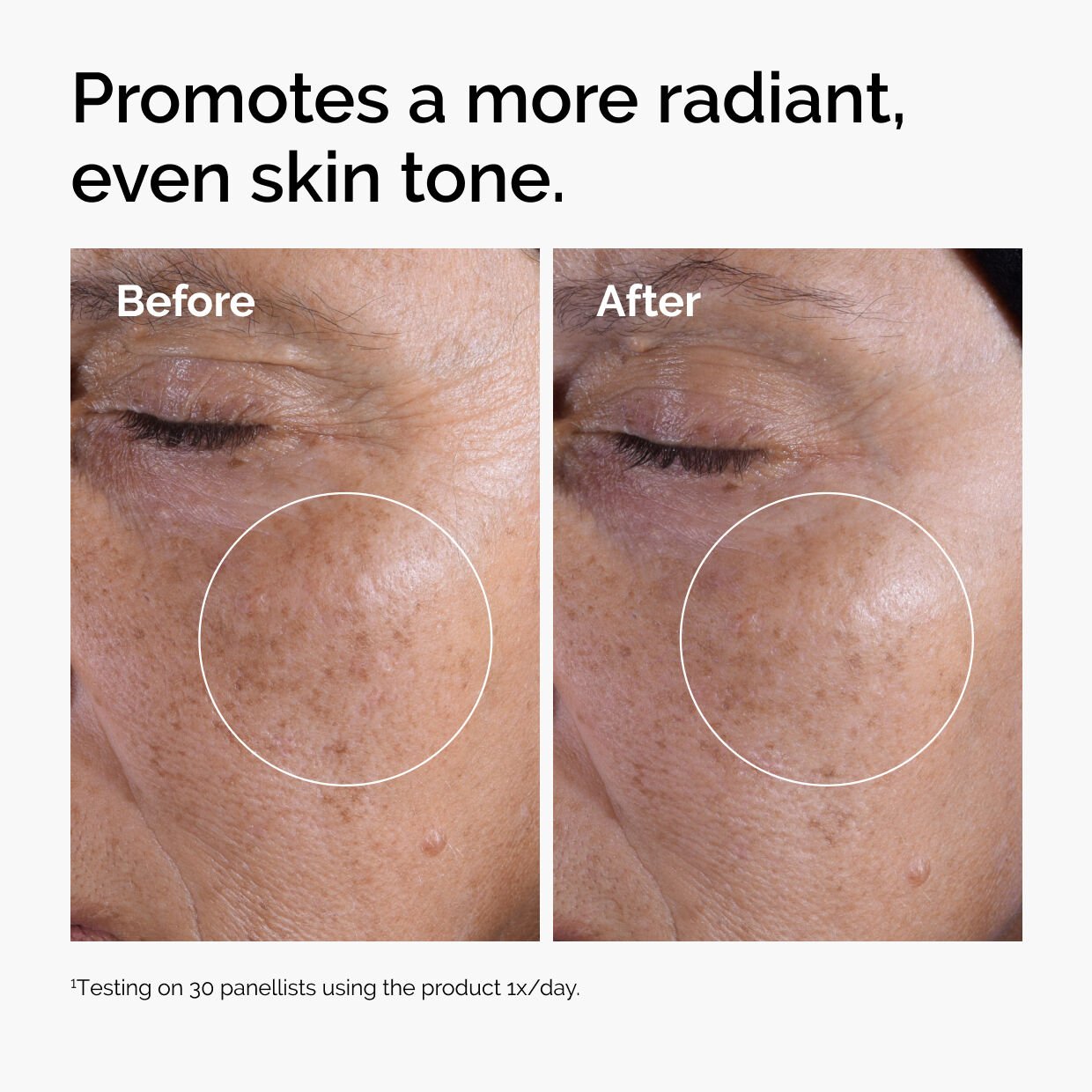 The Glycolic Acid Set - Image 2